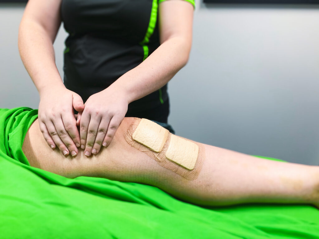 This image shows a person receiving a Manual Lymphatic Drainage treatment following their ACL surgery. The knee is bandaged and the practitioner is working on the clients thigh.