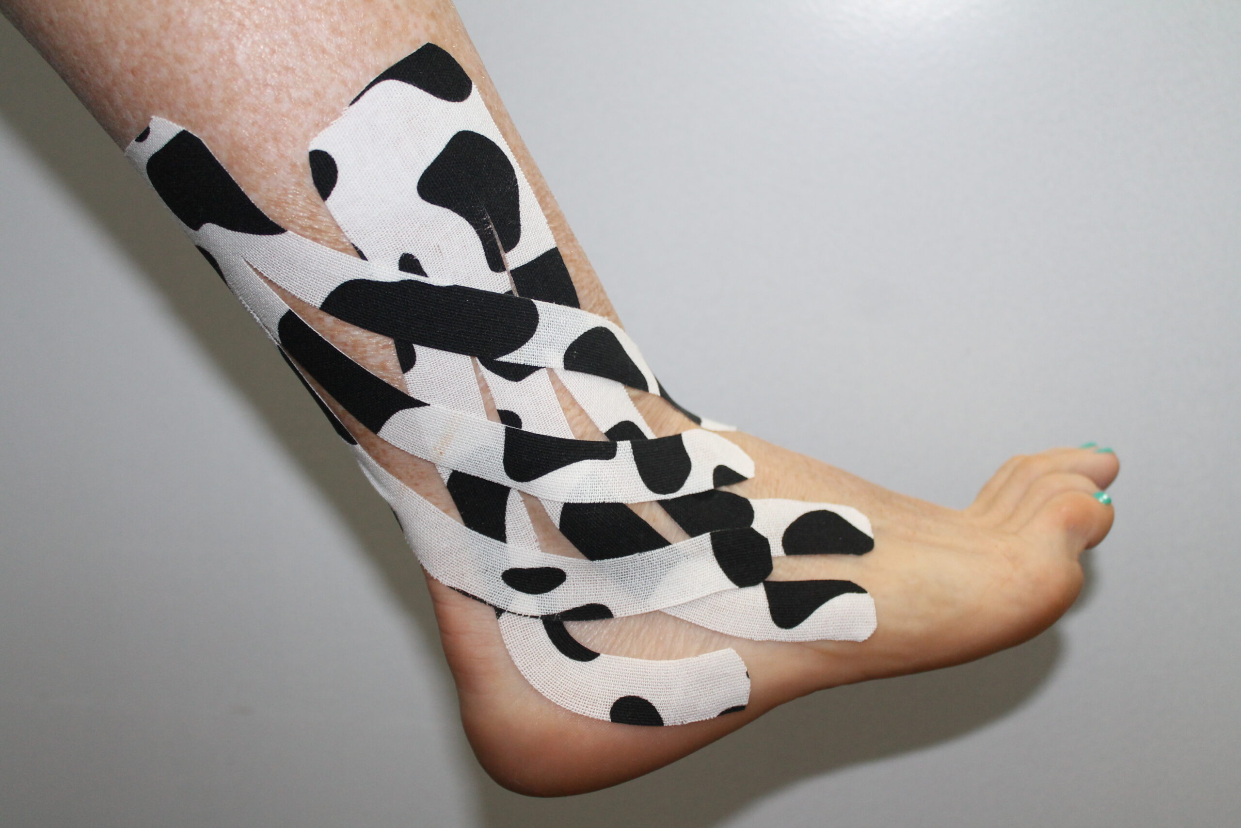 This image show a client with kinesiology tape on their ankle. the tape runs from their lower leg to the middle of their foot