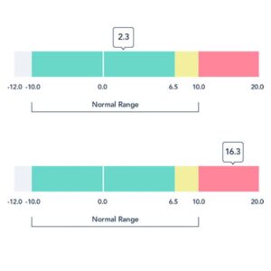 L Dex Score